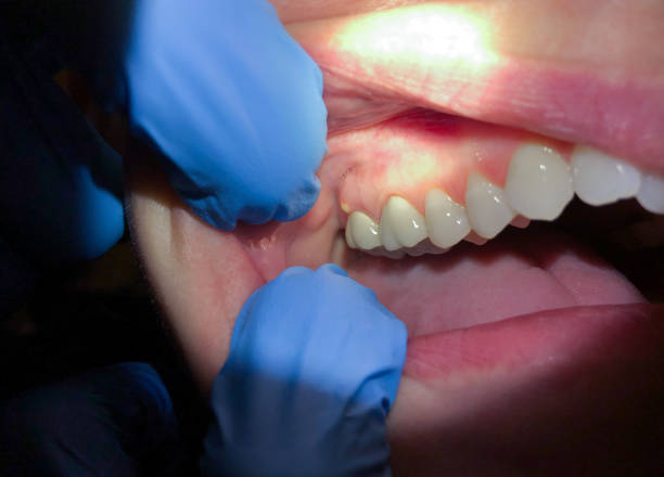Best Holiday Emergency Dentist in Evanston, IL
