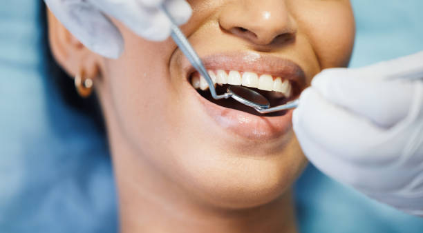 Best Emergency Root Canal Treatment in Evanston, IL
