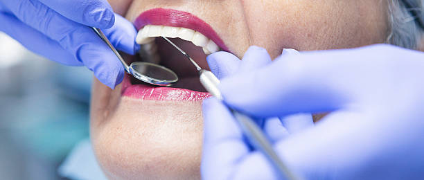 Best Emergency Dentist for Knocked-Out Tooth in Evanston, IL